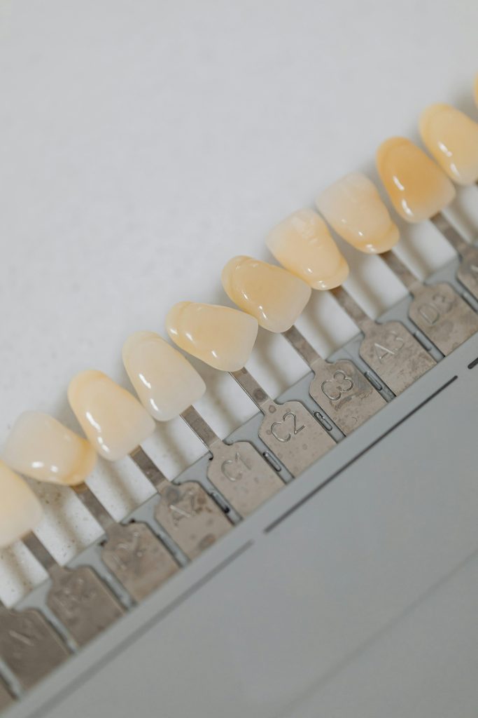 Gros plan sur un guide de teintes dentaires illustrant différentes options de couleur de dents pour des procédures dentaires.